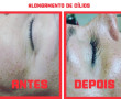 Antes & Depois