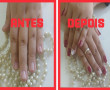 Antes & Depois